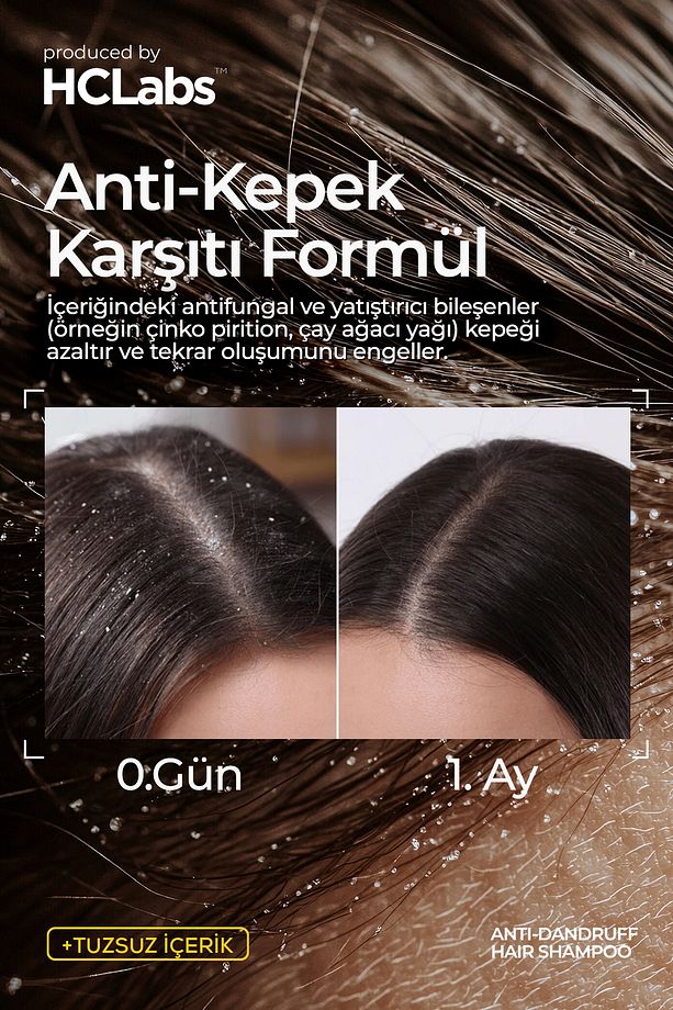 Anti Dandruff Kepek Karşıtı 15 Aktif Içerikli Tuzsuz Şampuan 250 ml - 2