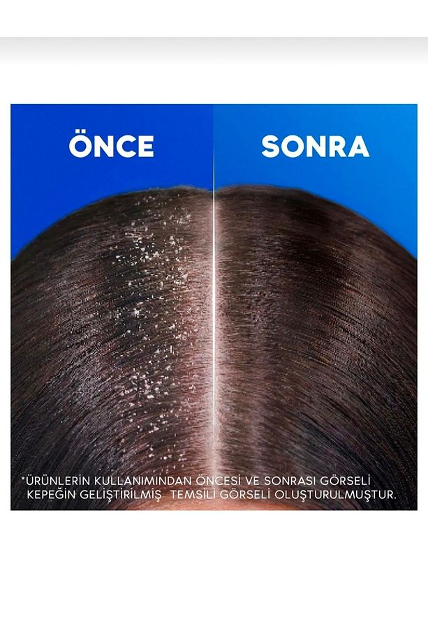 Hassas Saç Derisi Aloe Vera Şampuan 330 ML 6 Adet - 4