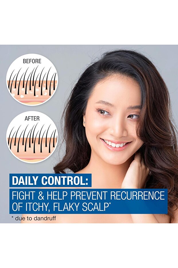 Scalp Therapy Anti-Dandruff Daily Control Şampuan 354 ML - 2