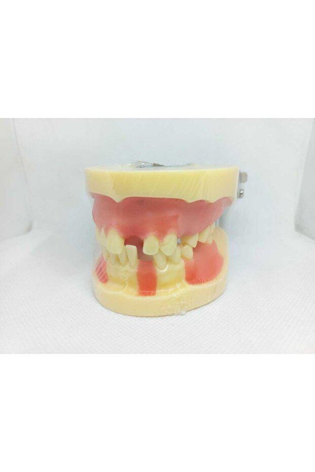 Çene Modeli no: 2003 - 1