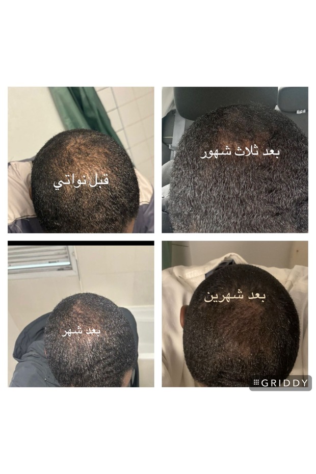 زيت الشعر الأصلي والعضوي من نواتي - تمر عجوة ونوى معتقة مع مزيج من الزيوت الطبيعية