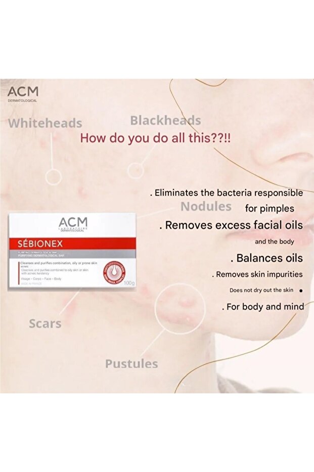 Sebionex Purifying Bar 100g –soap-free Daily Cleanser For Oily & Acne-prone Skin, Gentle & Effective - 2