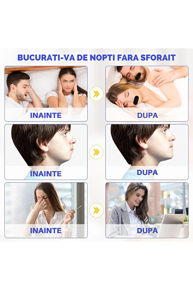 Set of 30 Binovation® Anti-Snoring Patch Strips, Hypoallergenic Material, Moisture Resistant - 5