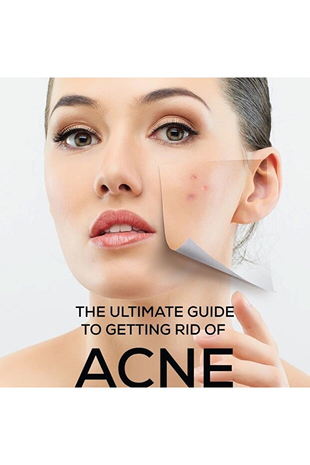 Sebionex Purifying Bar 100g –soap-free Daily Cleanser For Oily & Acne-prone Skin, Gentle & Effective - 4