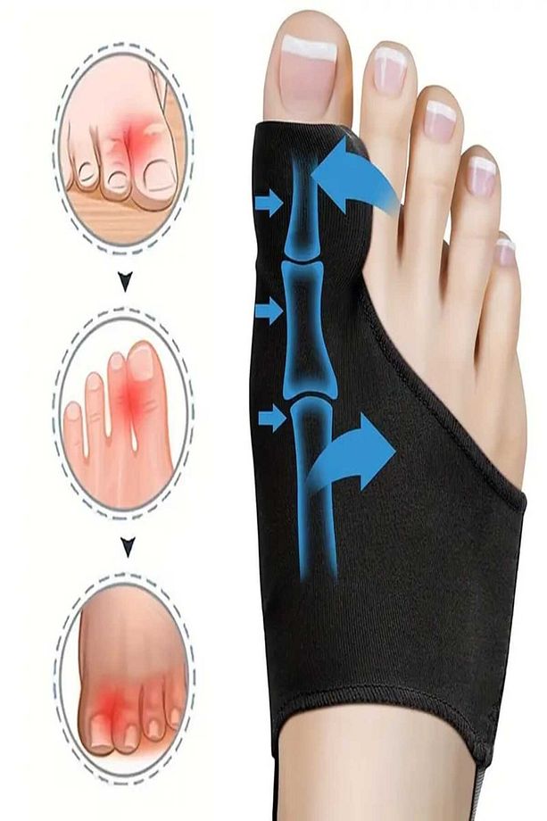 Çift Ayak Ateli Sağ Sol Gece Ateli Halluks Valgus Ateli Kemik Çıkıntısı Baş Parmak Kemiği Ateli - 7