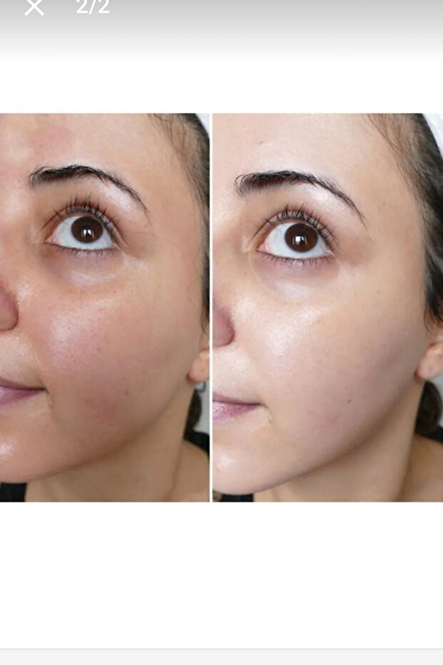 Cilt Beyazlatıcı Sabun - 1