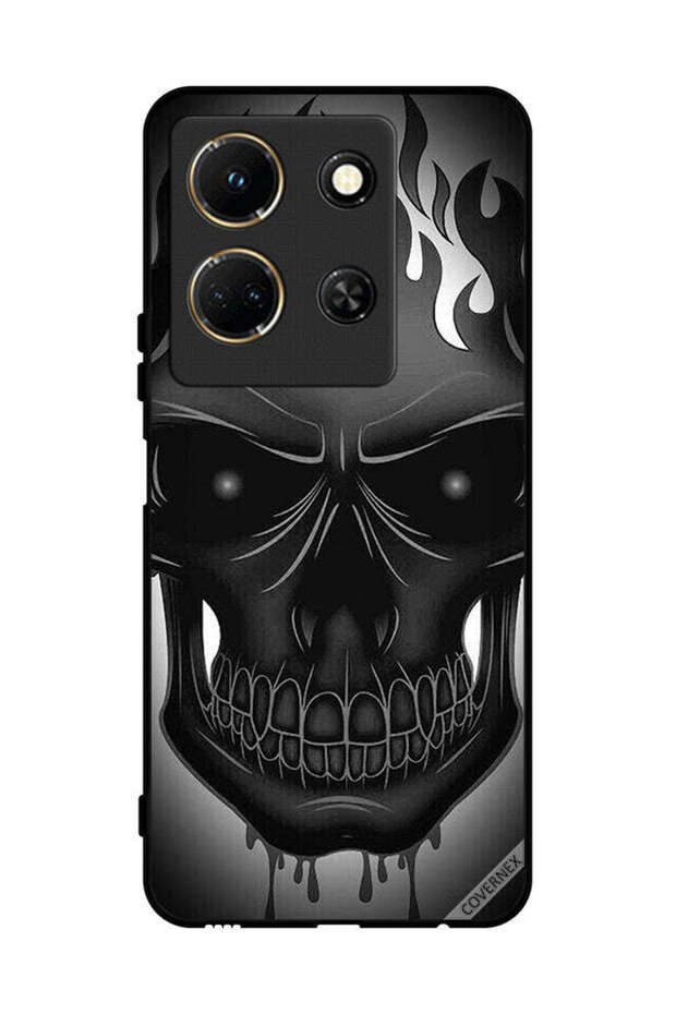 غطاء حماية لهاتف Infinix Note 30 بتصميم جمجمة