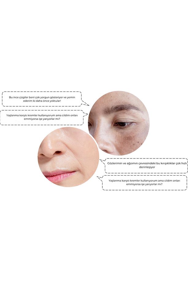 Retinol + Adenosin Mikro-İğne Teknolojili Kırışıklık Bandı 4 Adet - 6