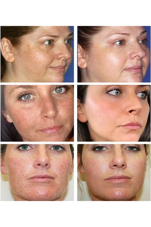 Kanza Krem 3lü Set - 2