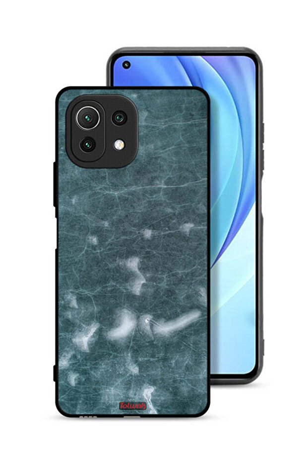 Xiaomi Mi 11 Lite Protective Case Cover Stonish Pattern