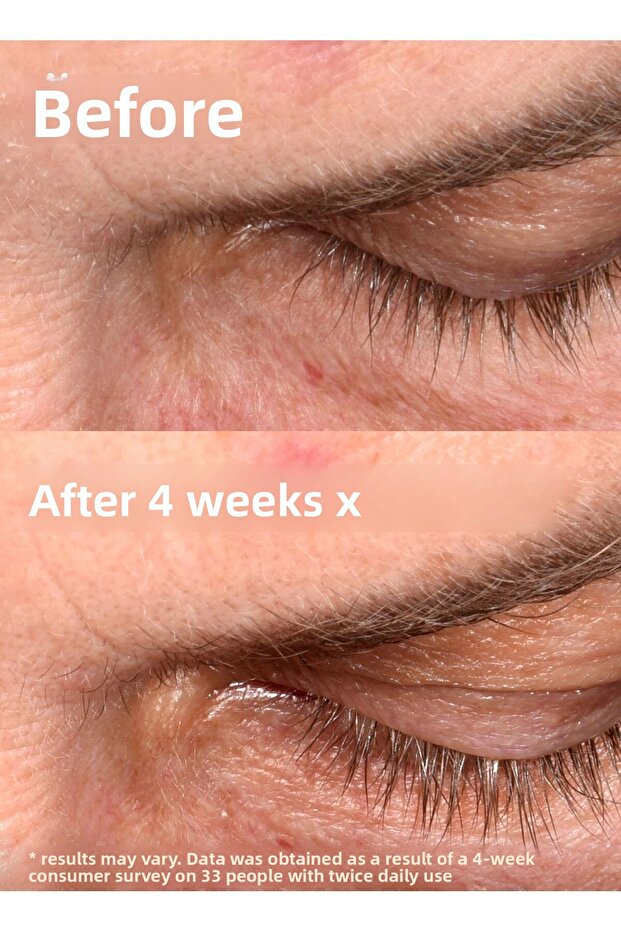 مصل بناء الرموش - 3