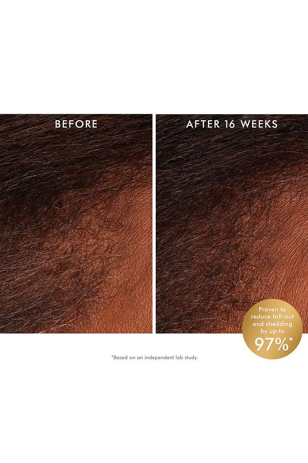 Revitalizing Scalp Tonik 100 ml - 5