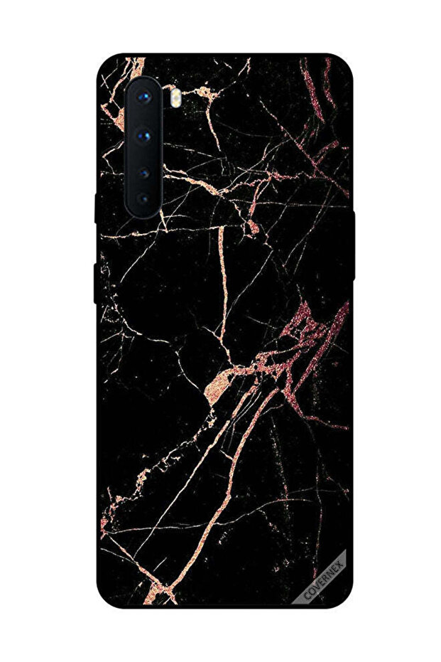 غطاء حماية لهاتف OnePlus Nord بنمط رخامي أسود