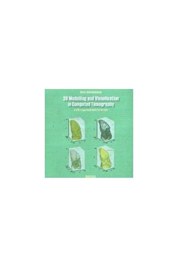 3D MODELLING AND VISUALIZATION IN COMPUTED TOMOGRA - 1