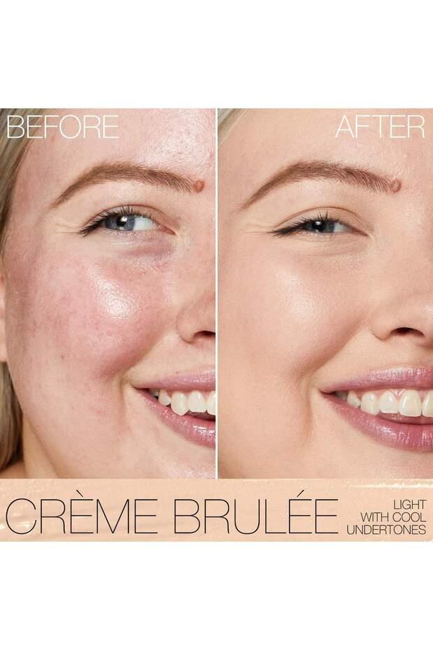 Radiant Creamy Concealer with Hydrating Medium Coverage - 2