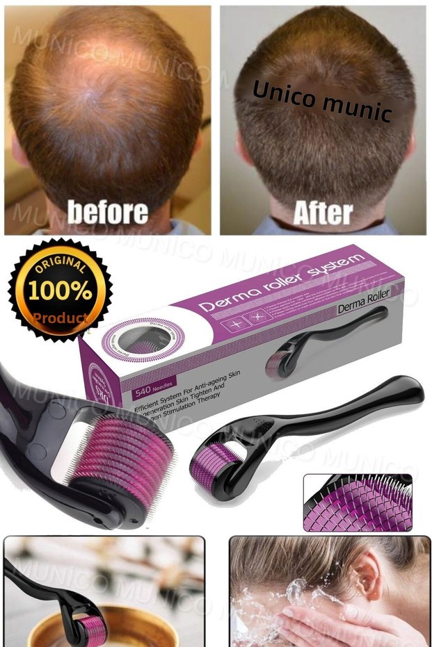Unisex Needle Derma Roller - Munico Beard and Hair Remover, Skin Rejuvenation and Pore Opening