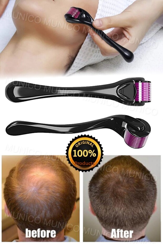 Beard and Hair Remover Roller: Skin Rejuvenation with Titanium Microneedle Facial Massager