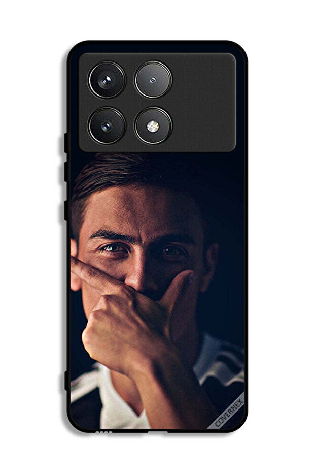 غطاء حماية لجهاز شاومي ريدمي K70 - باولو دي جي