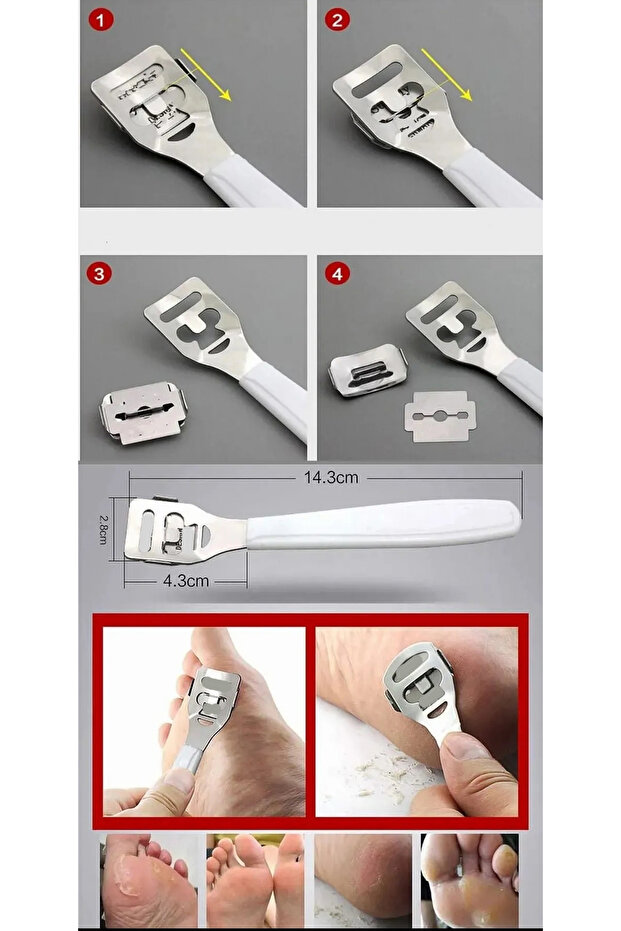 Raspa Aleti - Jiletli Ayak Topuk Törpüsü 2 adet Solingen Profesyonel 721900 - 5