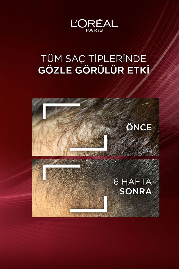Komple Direnç Dökülme Karşıtı Şampuan 300 ml - 3