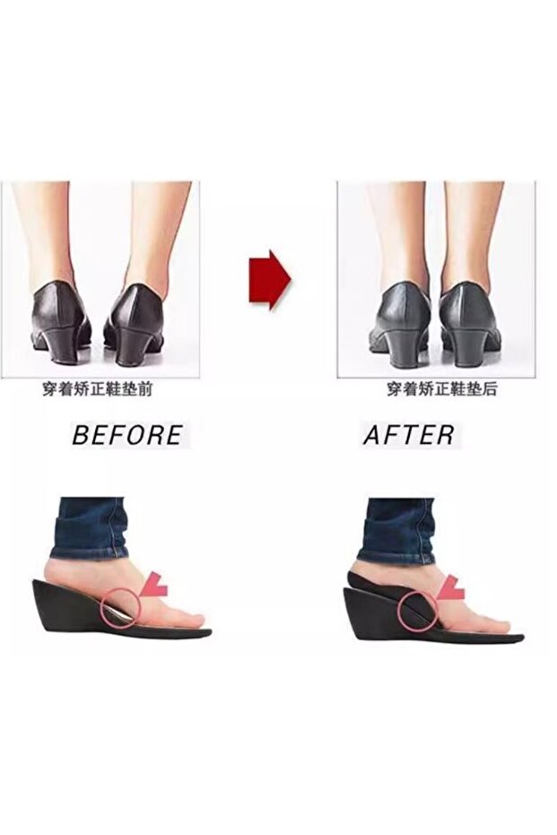 HVT Esnek Düz Taban Düzeltici Topuk Yastığı - 3