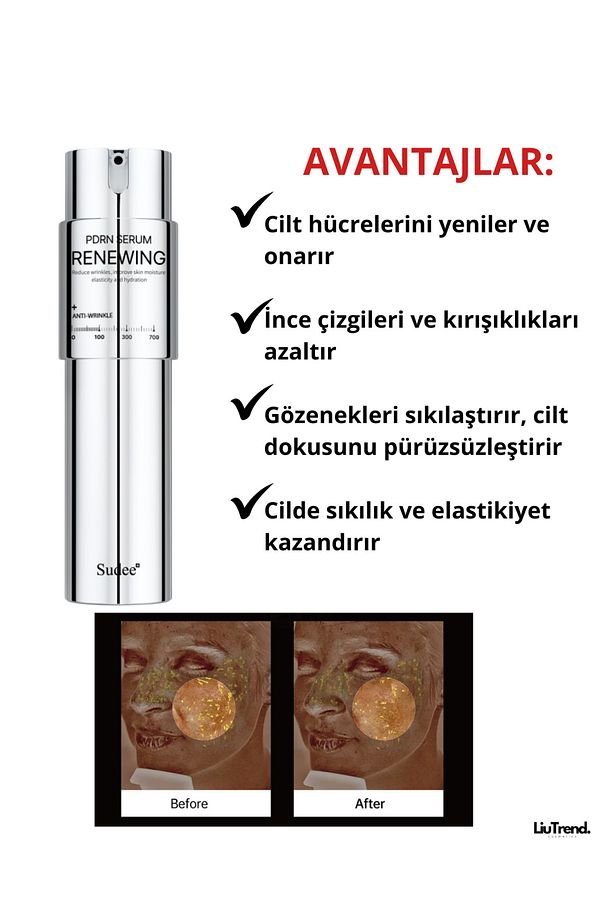 100 Pdrn Renewing Serum 30 ml Pdrn Ve Mikroiğneli Güçlendirici Serum - 3