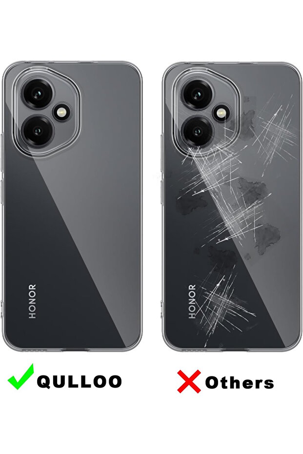 Honor 400 Case Soft Transparent Silicone Colorless Cover with Camera Protrusion Protection - 4