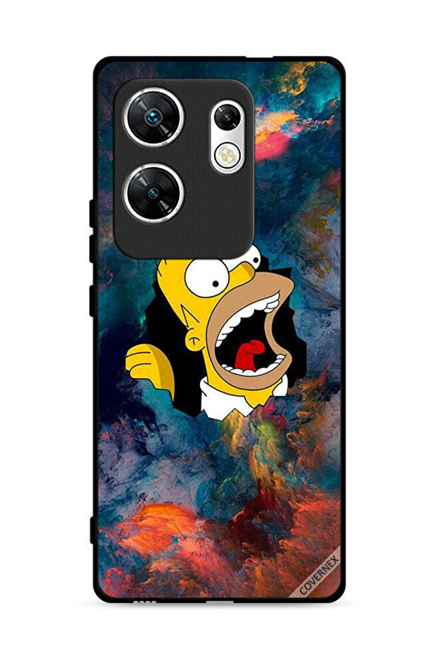 Infinix Zero 30 4G Protective Case Cover Simpson