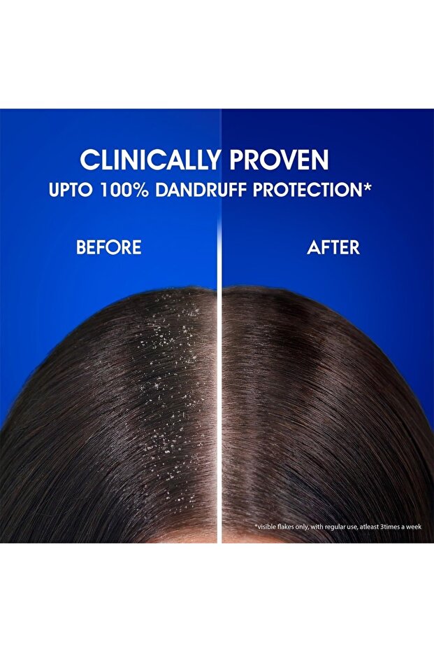 Head & Shoulders Deep Clean Flaky Scalp Sea Minerals Anti-Dandruff Shampoo Value Pack 2 x 400 ml - 4