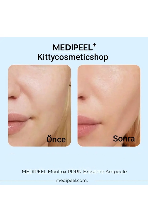 Mooltox PDRN Eksozom Ampul, 50 ml - 4
