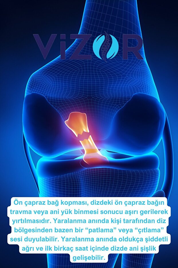 Code 506 Ön Çapraz Bağ Destekli Dizlik - 3