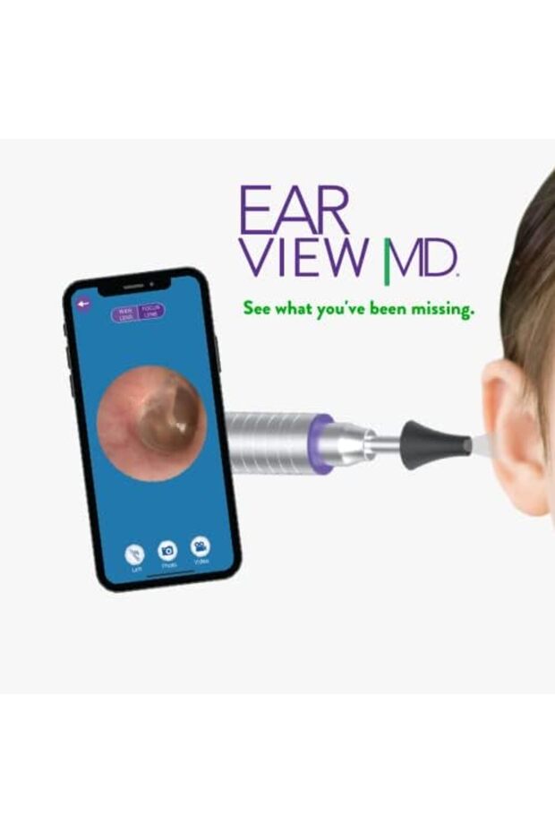 مجهر كاميرا أذن واي فاي - 2