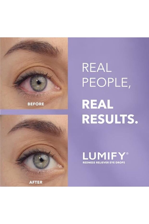 Lumify 0.025% Eye Drops 7Ml - 3