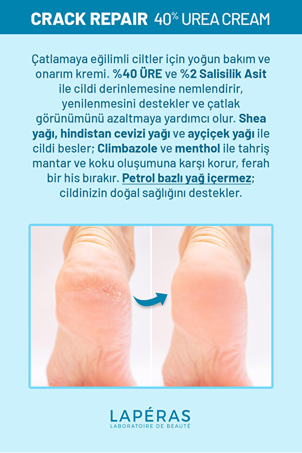Ayak ve Topuk Çatlak Bakım Kremi %40 Üre ve %2 Salisilik Asit 75ml - 2