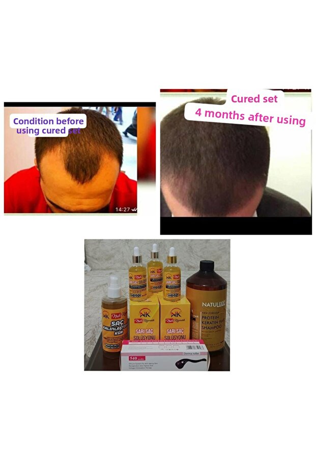 مجموعة معالجة - 2