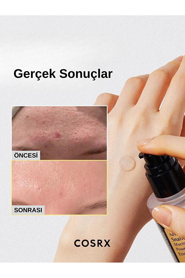 100 مل خلاصة الحلزون المتقدمة 96 Mucin Power - خلاصة الحلزون المرطبة والمغذية - 4