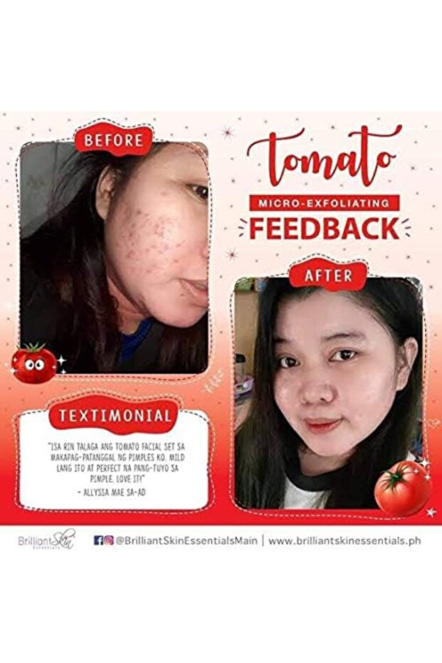 مجموعة الطماطم - 3