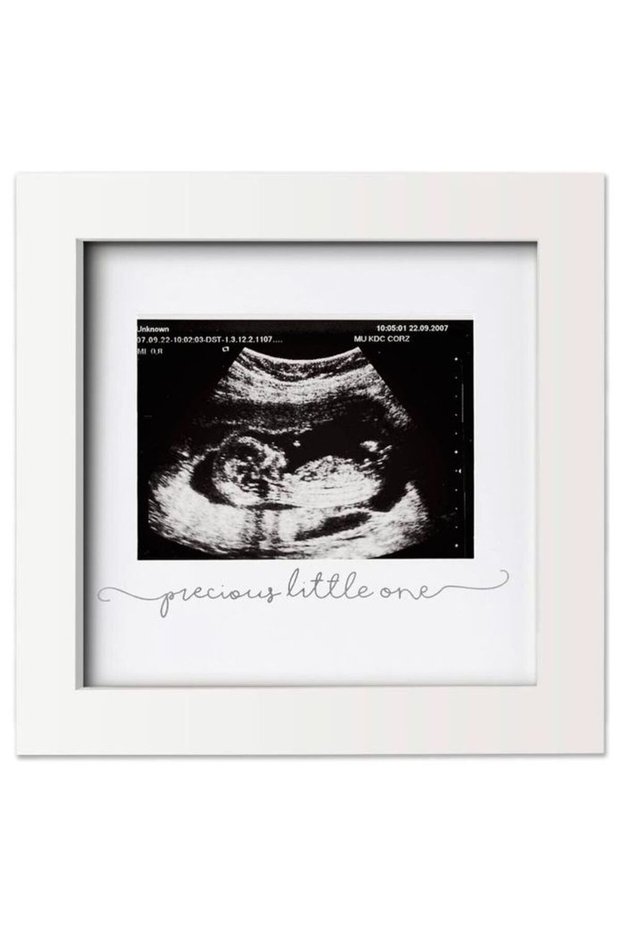 - Sonogram Frame - Alpine White