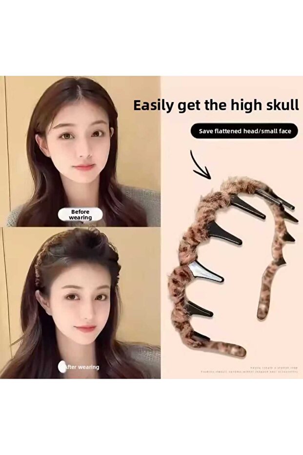 Özel Tasarım Taç - 7