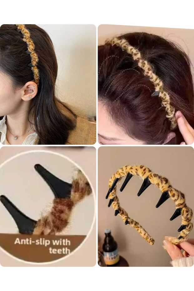 Özel Tasarım Taç - 5