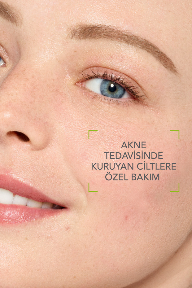 Sebium Hydra Yoğun Nemlendirici Seramid İçeren Kurutucu Akne Tedavisi Yatıştırıcı Bakım Kremi 40 ml - 3
