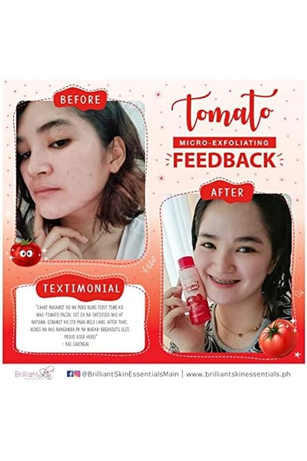 مجموعة الطماطم - 6