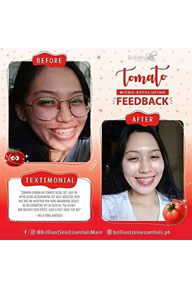 مجموعة الطماطم - 7