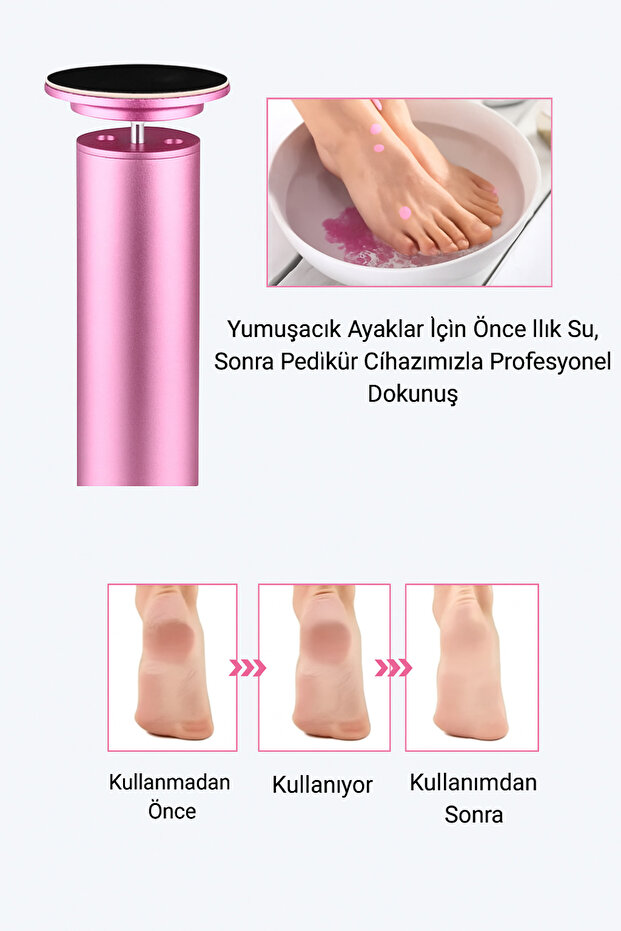 PEDİKÜR & AYAK TÖRPÜSÜ + 60 ADET ZIMPARA SETİ ( 7-10 İŞ GÜNÜ İÇERİSİNDE TESLİMAT ) - 2