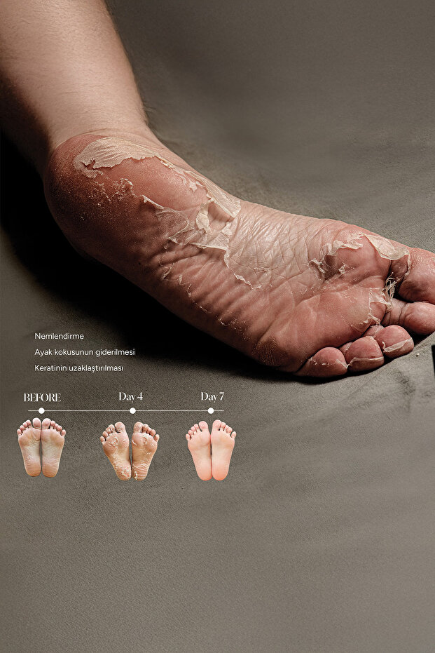 4'lü Çorap Tipi Ayak Peeling Maskesi Seti - 6