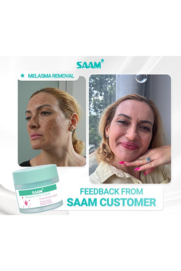 Renewal Face Cream - All-in-One Solution for Melasma & Freckles - 8