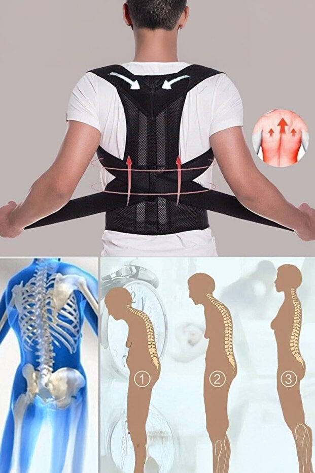 Upright Posture Corset Women Men Humpback for Standing Upright Kyphosis Back Pain Relief Supportive Anti Allergic Underwire Corset