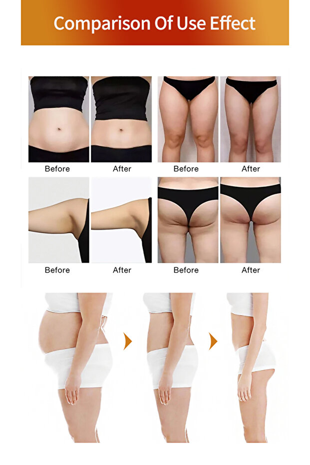 Slim Patch Göbek Bandı Patch Göbek 30 Adet - 2