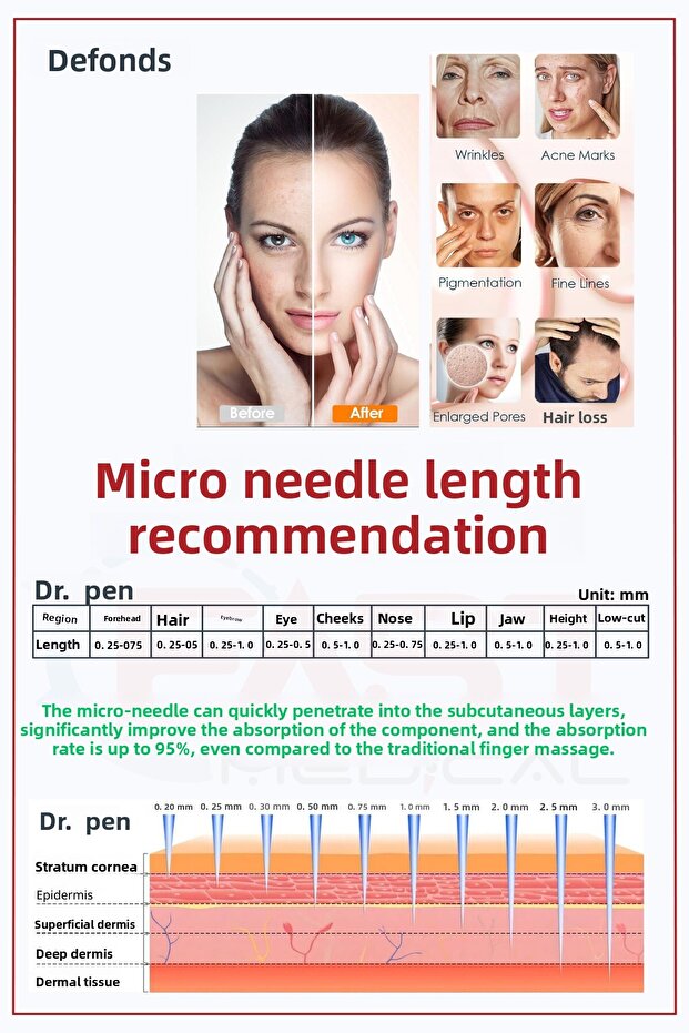 Dr Pen A6-A10-A1-N2-M5-M7-E30-Mym Compatible Needles 10 Pieces Original 12-Pin Dermapen Needle Cartridge - 4
