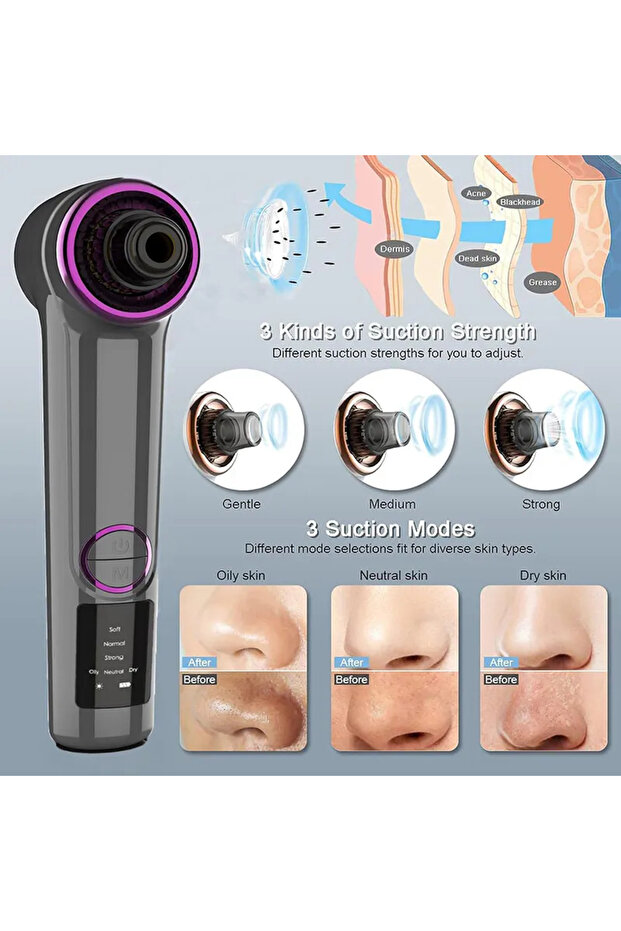 Blackhead Remover, with SINZO® Vacuum, 3 suction programs, USB charging - 2